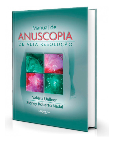 Livro Manual De Anuscopia De Alta Resolução, 1ª Edição 2021