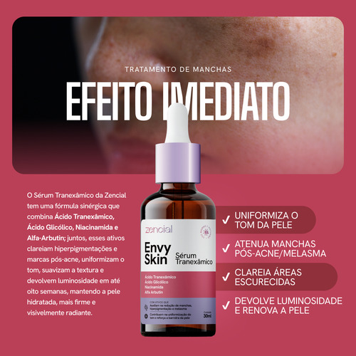 Sérum Facial Melasma E Acne Com Ácido Tranexâmico Acneica Noite