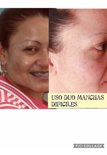 Piel De Porcelana Duo,manchas Faciales - - L a $568