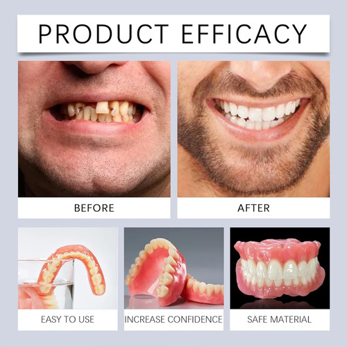 Conjunto De Prótese De Silicone Portátil, Smile Naturally