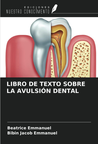 Libro: Libro De Texto Sobre La Avulsión Dental (spanish Edit