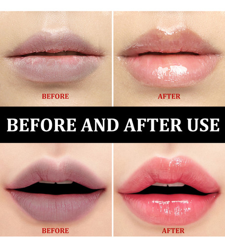 Bálsamo Exfoliante Aclarador De Labios, Hidratante Labial, U
