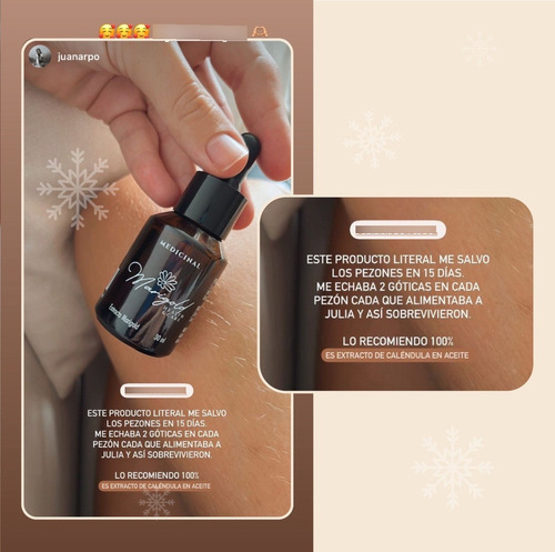 Extracto Puro Caléndula Oleo Natural Cicatrizante 30 Ml