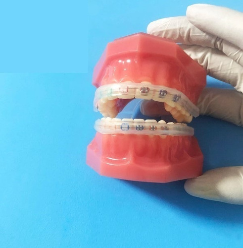 Imagen 7 de 9 de Protección Para Ortodoncia Bracket Protege Labios Y Mejillas