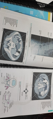 Anatomía Humana Latarjet 5 Edición Tomo 1 Y 2 Full Color A4