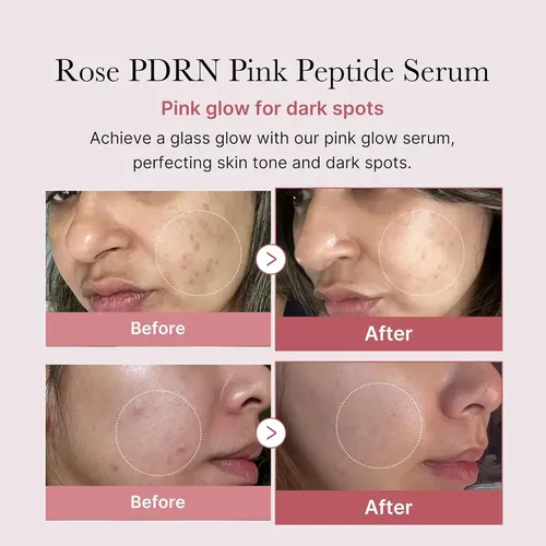 S&eacute;rum Facial Medicube Pdrn Pink 5 Pept&iacute;deos - Normal Dia/noite