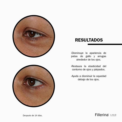 Imagen 6 de 9 de Tratamiento De Relleno Fillerina Ojos Y Párpados Grado 5