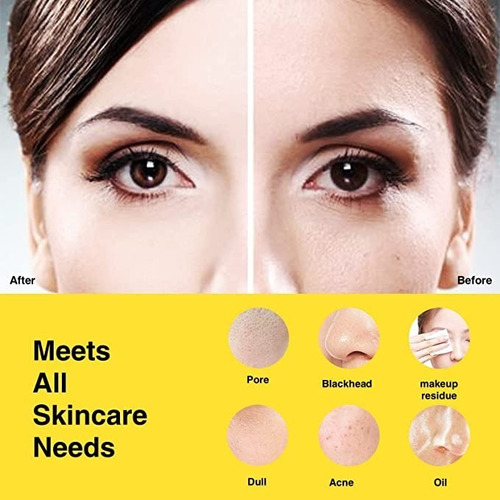 Någracoola Clie Cepillo De Limpieza Facial Sónico Impermeabl