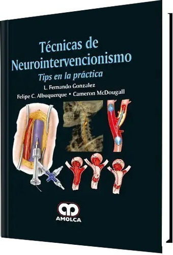 Técnicas De Neurointervencionismo Tips En La Práctica