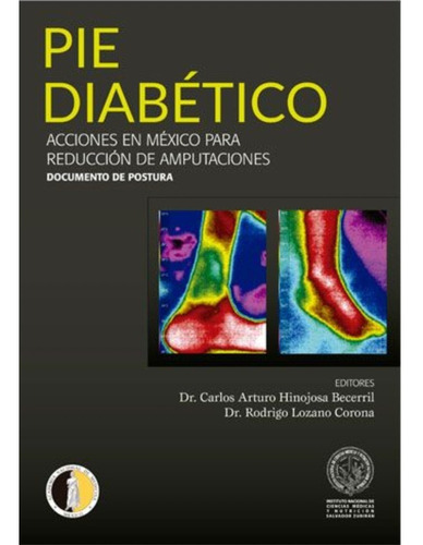 Pie Diabetico -acciones En Mexico Para Reduccion De Amputaci