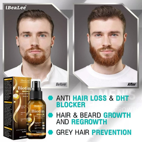- Óleos De Crescimento Em Spray Para Cabelo Anti-queda De