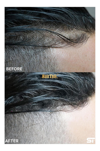 Kit 9-en-1: Fibras Para Reconstruir Cabello, 25g