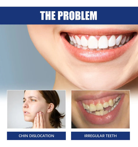 Alineación Mandibular De 3 Problemas, Solución: Pinza -