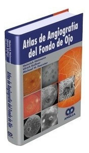 Atlas De Angiografía Del Fondo De Ojo