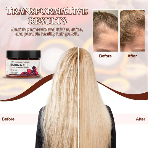 Mox Aceite Capilar Batana, Crecimiento Del Cabello, Pérdida