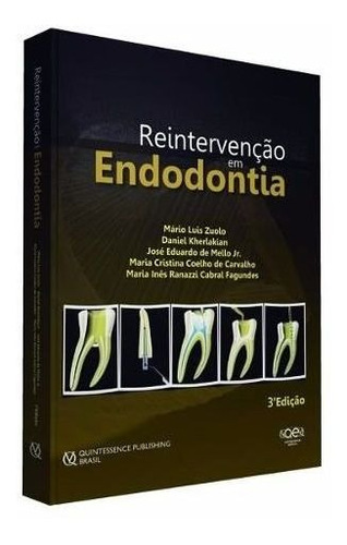 Livro Reintervenção Em Endodontia 3ª Edição