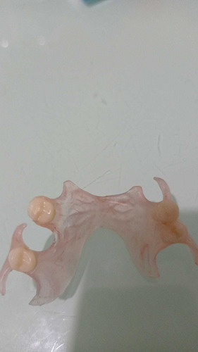 Imagen 4 de 5 de Laboratorio Dental.protesis Comunes Y Flexibles