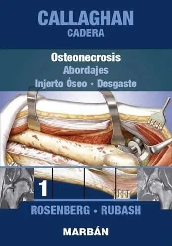 Cadera Osteonecrosis Tomo 1 Callaghan Abordajes-injertos Ó