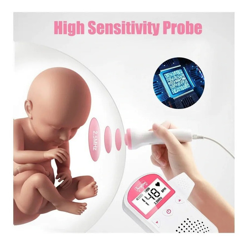 Ultrasonido Prenatal Latidos Corazón Bebe Envìo Inmediato