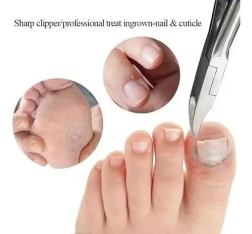 P Tijeras Acero Inoxidable Para Cortar Uñas Encarnadas