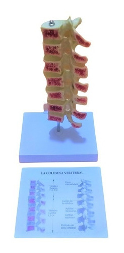 Figura Anatómicas: Columnas Vertebral