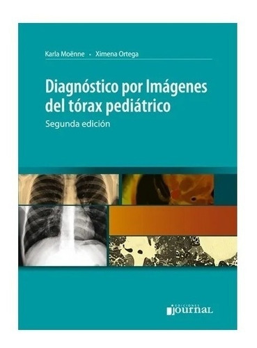 Diagnostico Por Imagenes Del Torax Pediatrico 2ed Nuevo!