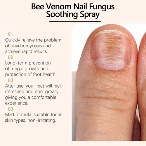 Spray Botella De Calmantes Bee Venom En Las Uñas 2pcs