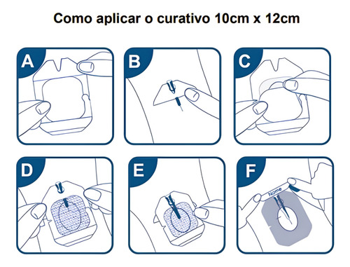 Curativo De Fixação Iv M-tec 10cm X 12cm Unidade/placa