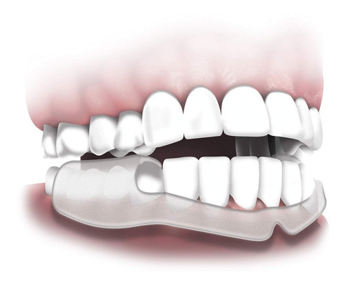 Imagen 1 de 3 de Protector Bucal Dental Para Adultos Bruxismo Marca Plackers