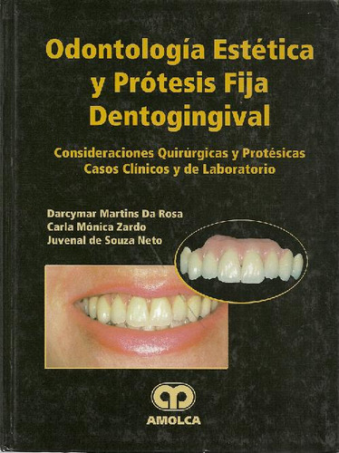 Libro Odontología Estética Y Prótesis Fija Dentogingival De