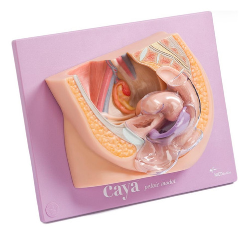 Anticonceptivo Diafragma + Gel Caya