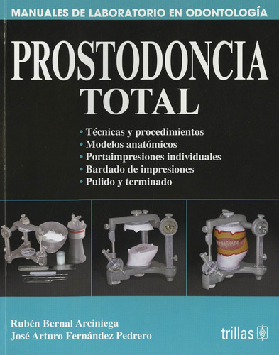 Prostodoncia Total