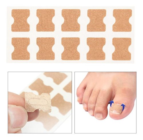 Reparação De Unhas Do Dedo Do Pé Encravada 1 Folha