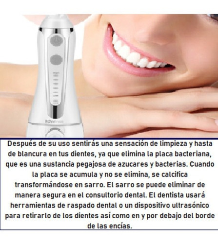 Irrigador Dental Limpieza Bucal Blanco H2ofloss Pórtatil.