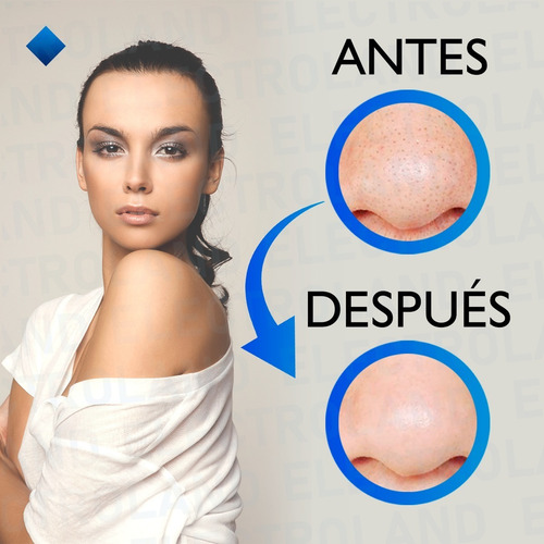 Imagen 6 de 10 de Microdermoabrasion Punta Diamante Peeling Puntos Negros Rec
