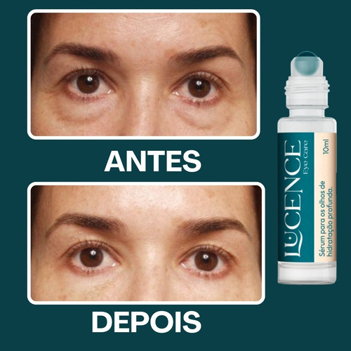 Kit Lucence Para Pele E Orelhas Uniformiza Hidrata Restaura Todo Tipo De Pele Dia/noite