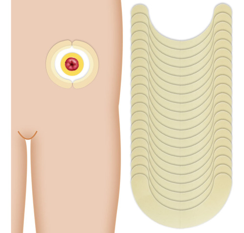 Suministros De Ostomia, Tiras De Barrera De Ostomia, Tiras E