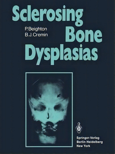 Sclerosing Bone Dysplasias, De Peter Beighton. Editorial Springer London Ltd, Tapa Blanda En Inglés