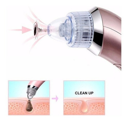 Extractor Espinillas Puntos Negros Vacuum Facial Peeling