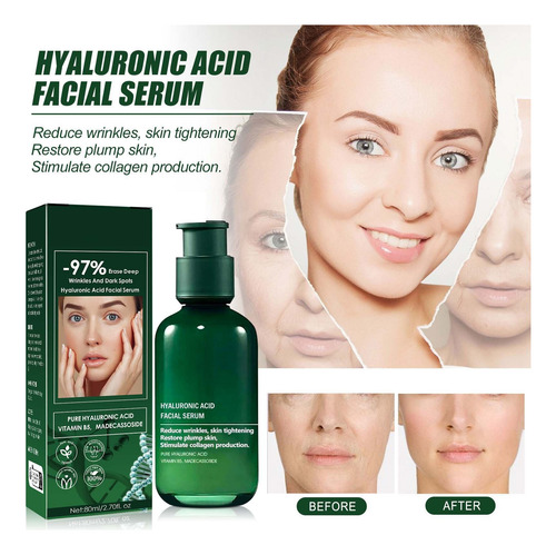 S Facial Hydrating Moisturizing Skin Care Refreshing No 4001