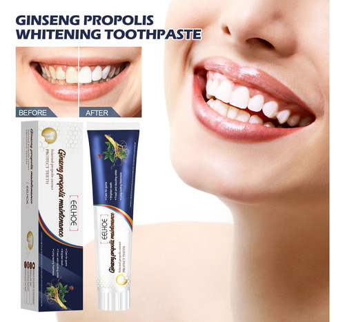 Clareamento De Própolis De Ginseng Como Dor Dentária, Dentes