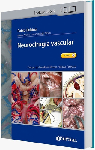 Rubino / Arévalo / Bottan Neurocirugía Vascular C/env