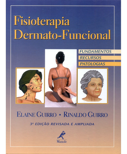 Fisioterapia dermato-funcional: Fundamentos, recursos, patologias, de Guirro, Elaine. Editora Manole LTDA, capa dura em português, 2003