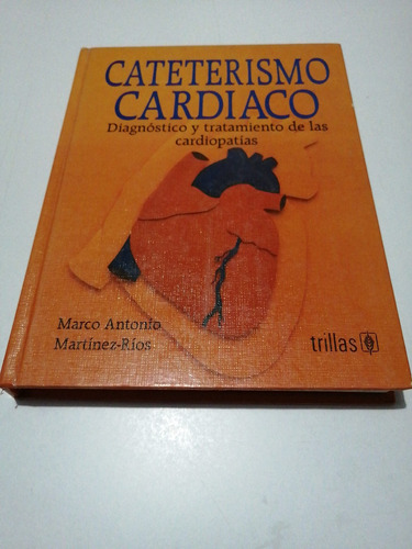 Cateterismo Cardíaco Marco Antonio Martínez Ríos 