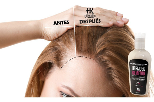 Imagen 4 de 10 de 3 Shampoo Crecimiento Anti Caída Reparador Frizz Mujer 7en1