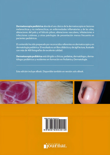 Dermatoscopia Pediatrica