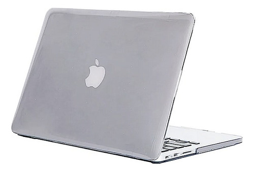 Carcasa Case + Protector Para Macbook Pro Retina A1502/a1425