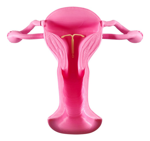 Aparato Genital Femenino + Diu Impresión 3d