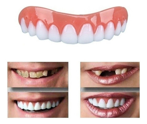 Perfecto Instant Smile Comfort Fit Flex Dientes Superiores W