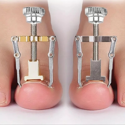 Herramienta Para Sacar Uñas Enterradas Removedor Uñeros